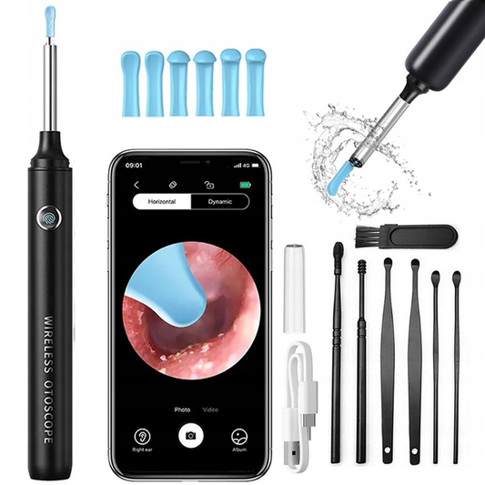 SMART OTOSKOP Z KAMERĄ + APLIKACJA NA TELEFON